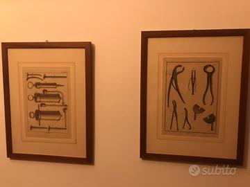 Vecchie stampe di antichi oggetti medici