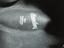 Immagine 3