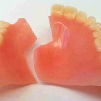 Riparazione Protesi Dentale/Dentiera