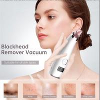 Aspiratore punti neri viso