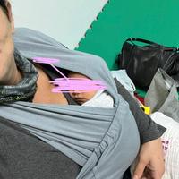 Fascia elastica neonato