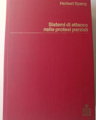Sistemi di attacco nelle protesi parziali