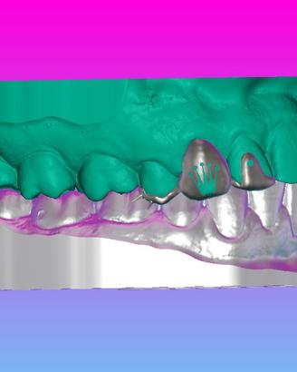 Grillz