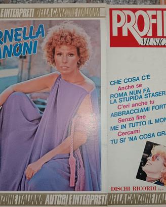 Vinile