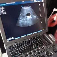 ECOGRAFO PORTATILE 3 SONDE MULTIDISCIPLINARE 