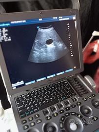 ECOGRAFO PORTATILE 3 SONDE MULTIDISCIPLINARE 