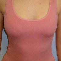 Lotto di 100 canotte con corpetto interno - ROSA