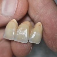 Ceramista odontotecnico