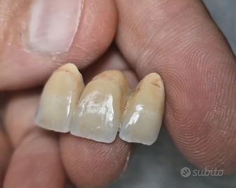 Ceramista odontotecnico