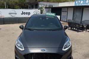 Ford Fiesta 1.5 TDCi 5 porte ST-Line