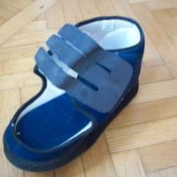 scarpa post operatoria