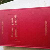 Corone, ponti e protesi parziali - Koller