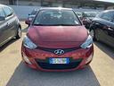 hyundai-i20-1-4-crdi-5p-sound-edition