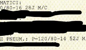 Gomme Kymco Agility 200