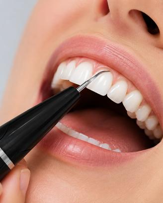 Pulitore Dentale Ultrasuoni ONHERM