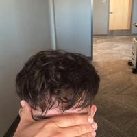 Protesi per capelli