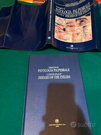 PATOLOGIA PALPEBRALE IMMAGINI