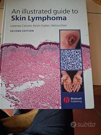 Anatomia patologica Skin Lymphoma Cerroni Kerl