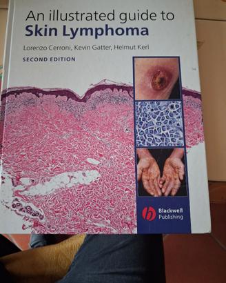 Anatomia patologica Skin Lymphoma Cerroni Kerl