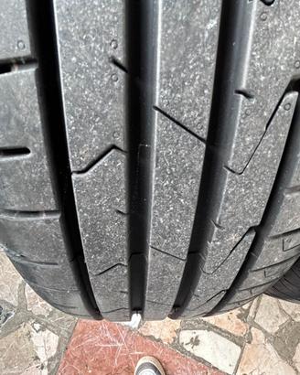 Gomme