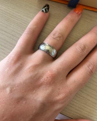 anello LV