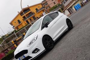 Ford Fiesta 1.1 St-Line 86cv Benzina/GPL