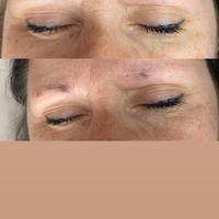 Stiro , microblading