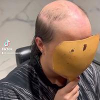 Protesi capelli donna e uomo