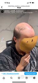 Protesi capelli donna e uomo