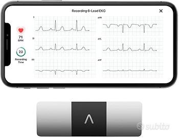 AliveCor KardiaMobile 6L ECG di livello medico | L