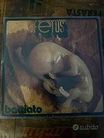 Battiato fetus