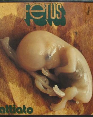 franco battiato fetus vinile prima stampa  1972