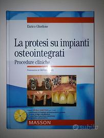 Odontoiatria La protesi su impianti osteointegrati