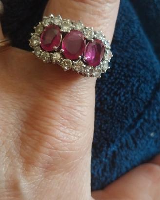 anello