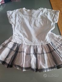 vestitino bambina burberry 