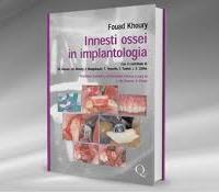 Innesti ossei in implantologia f.khoury