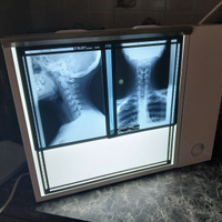 Negativoscopio nuovo