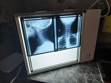 Negativoscopio nuovo