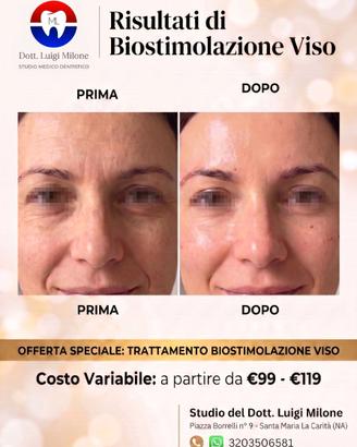 Biostimolazione, filler, botox, labbra, rinofiler