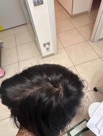 PROTESI CNC (PARRUCCA)