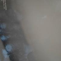 Xiaomi 11 lite non funzionante 