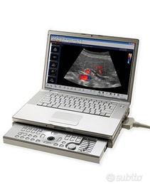 ecocolor doppler  ecocardio portatile