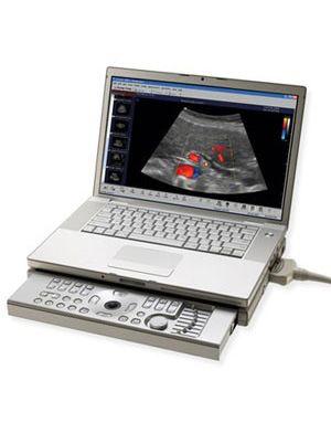 ecocolor doppler  ecocardio portatile