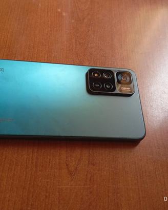 Xiaomi Redmi note 11 pro