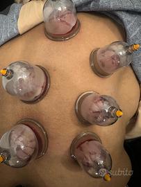 Servizio a domicilio di Coppettazione (Hijama)