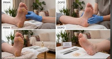 PEDICURE PROFESSIONALE A DOMICILIO