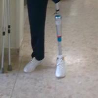 Ottobock Genium C-Leg ginocchio + Protesi