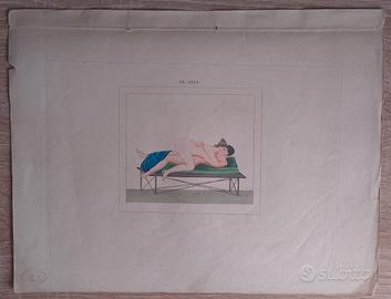 Lotto 6 Stampe Erotiche Antiche 1830 Napoli Pompei