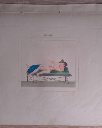 Lotto 6 Stampe Erotiche Antiche 1830 Napoli Pompei