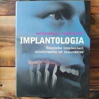 libro implant. Matteo Capelli - Tiziano Testori